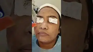 Glycolic Medifacial | Vogueclinix | Treatment Facial 