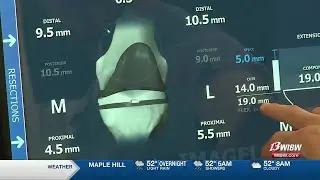 New technology could lead to better success for knee replacements
