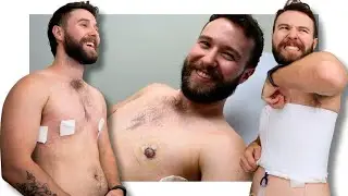 My Post OP Recovery & Results | Top Surgery Vlog Part 2