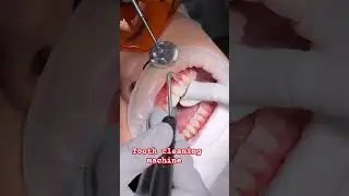Tooth cleaning machine #short#virul#trending #video