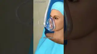 Pectus Excavatum And Nuss Procedure #pectusexcavatum? #pectusexcavatumsurgery #pectusexcavatumfix