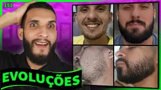 EVOLUÇÕES  COM MINOXIDIL (resultados dos inscritos) #152