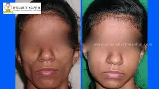 Cosmetic And Plastic Surgery by Dr. R Jayakumar | Plastic, Cosmetic and Micro Vascular Surgeon Kochi