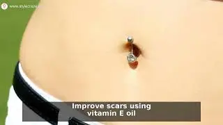 7 Proven Ways to Fade Belly Button Piercing Scars