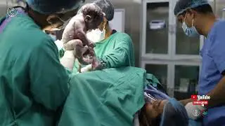 IVF Success Story in Pokhara | Baby Delivered by Dr. Gir Dhari Sharma & Team
