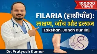 Filaria : फाइलेरिया के कारण, लक्षण और इलाज | Dr. Pratyush Kumar | Physician | Filaria specialist