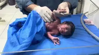Haleema Baby Care: Underweight IUGR Newborn&rsquo;s First Breath & Cry |ولادت بچے کی پہلی سانس اور رونا