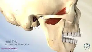 TMJ Closed Lock