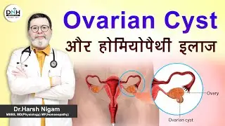 Ovarian Cyst और Homoeopathy इलाज