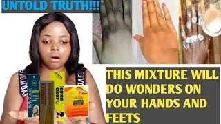HOW TO PROMIX DARK KNUCKLE CREAM /Get Rid Of dark knuckles