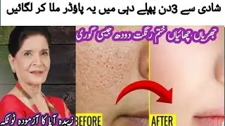 Natural anti aging cream/Erase Fine Lines Naturally Your Kitchen Secret for Radiant Glowing Skin