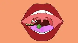 Do you know How Tonsillitis occurs? Funnyscience animation 
