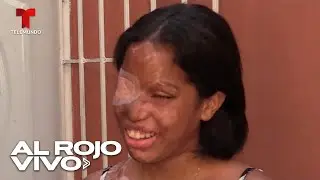 Imponen pena máxima a culpables de atacar con ácido a joven en República Dominicana