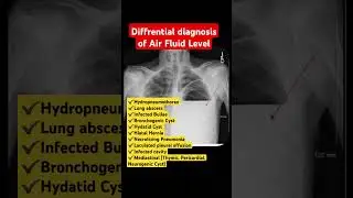 Air Fluid Level Diffrential Diagnosis #cxr #aiims #icu #neet #doctor #xray #fmge #nursing #medical