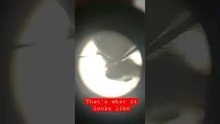 WHAT DOES A FLY LOOK LIKE UNDER A MICROSCOPE!