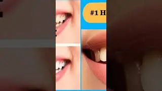 #1Home remedy