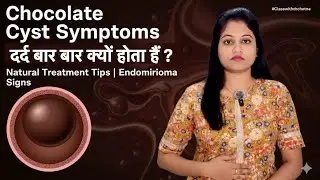 Chocolate Cyst Symptoms &ndash; दर्द बार-बार क्यों होता है? Natural Treatment Tips | Endometrioma Signs