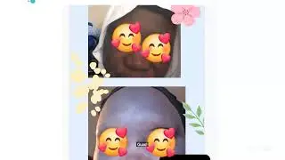 traitement acn&eacute;