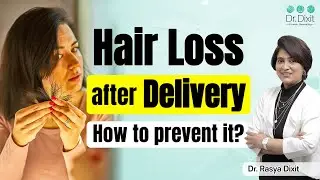 Post Pregnancy Hair Loss Treatment | Causes of Postpartum Hair Loss | Hair Clinic in Bangalore