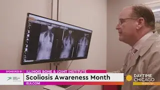 Illinois Bone & Joint Institute: Scoliosis Awareness Month