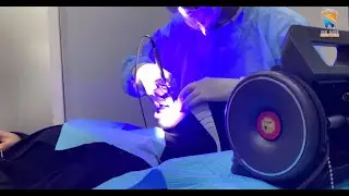 Teeth whitening using Pioon S1 Blue 3 Wavelength Diode Laser