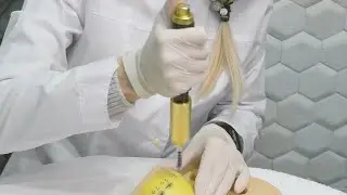 Hyaluronic Pen - Method of Operation