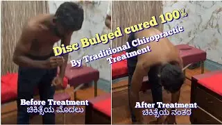 Disc bulge cured for a tiles mason worker by Chiropractor Mr. Eahthesham in #Mysore Call 9741949711