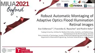 MIUA2021: Robust Automatic Montaging of Adaptive Optics Flood Illumination Retinal Images