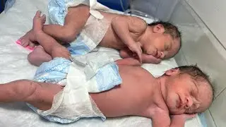 From Day One to Now | Cutest Twins Baby Full Journey