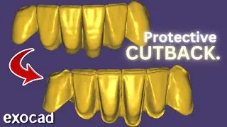 ANTI-CHIPPING Cutback. 2025 Tutorial EXOCAD