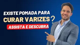 Existe pomada para tratar varizes? #varizes #vasinhos