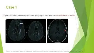 Radiologically Isolated syndrome 2023