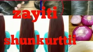 Haala zayiti shunkurtti ittin Qophesinu⬆️