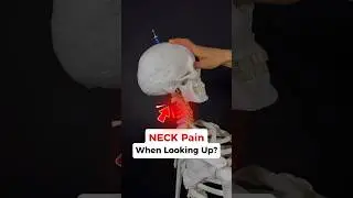 Try this QUICK exercise for NECK Pain when looking up! #neckpainrelief #neckpain #headaches #tmj