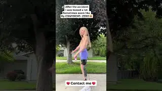 After Accident , I was teased every day 😖 #disabledwoman #lonelygirl #confidence
