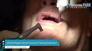 [MacArthur Park Dentistry] 6 Month Regular Dental Checkup & Cleaning Explanation