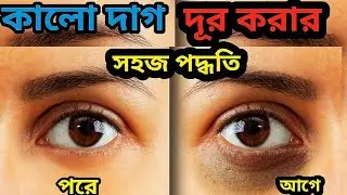 কালো দাগ দূর করার সহজ পদ্ধতি । DforU l 04.09.2022