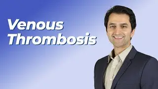 Hematology | Venous Thrombosis | 2025-2026 Internal Medicine Video Board Review