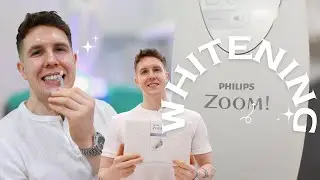 Expat Influencer Alex Bently's Smile Makeover with Zoom Whitening at Bangkok Smile Dental Clinic