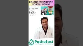 Leucocytes in Urine Normal Range | how many leucocytes in urine are normal? #urinereport #urine