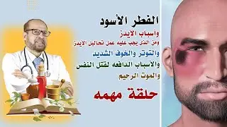 الفطر الأسود🍀 وأسباب الأيدز🍀 ومن الذى يجب عليه عمل تحاليل الأيدز🍀 والأسباب الدافعه لقتل النفس