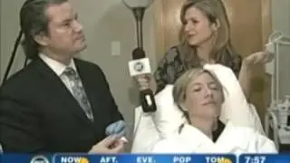 How Long Does Voluma Last?
