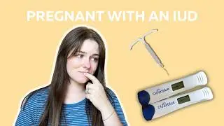 I Got Pregnant With an IUD (storytime)