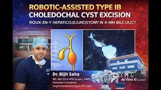 ROBOTIC-ASSISTED TYPE IB CHOLEDOCHAL CYST EXCISION WITH ROUX-EN-Y HEPATICOJEJUNOSTOMY