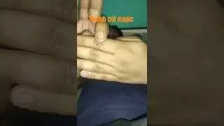 thumb cut magic trick #finger #viral