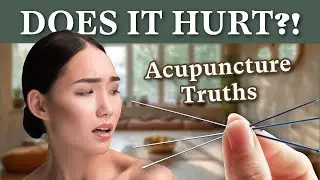 Does Acupuncture Hurt? The Truth About the Needles [Frederick, MD]