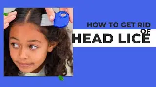 How to get rid of head lice? | Ivermectin | ivermite 6mg tablet   | Dr Zain the Healthier Pakistan