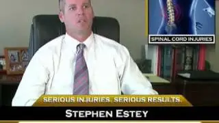 San Diego Spinal Cord Injury Lawyer