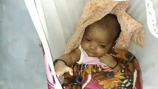 My Twins Baby Episode - 30