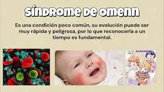 S&iacute;ndrome de Omenn  RuizM&eacute;dezDanielaYuridia  G   314 C ‐ Hecho con Clipchamp